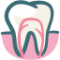 root-canal (1)